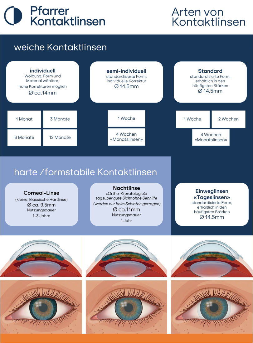 Übersichtsgrafik zu Arten von Kontaktlinsen für gesunde Augen