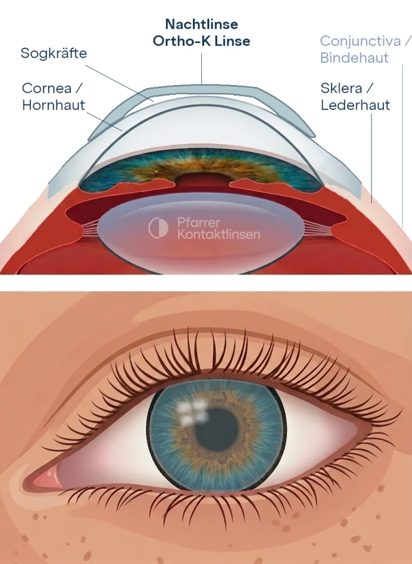 Schematisches Bild Nachtlinse